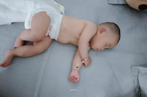 龙岩六个月宝宝眼睛散光
